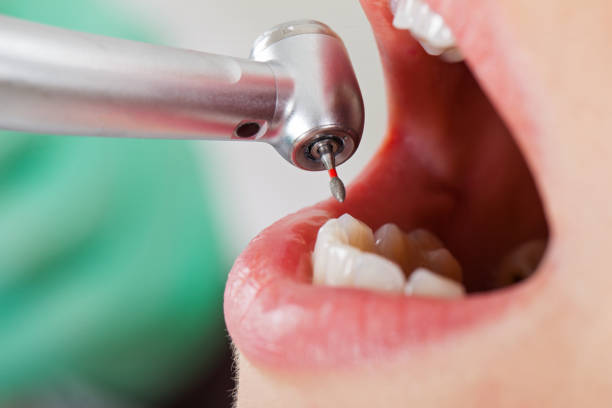 Best Emergency Broken Tooth Repair in Plainview, TX